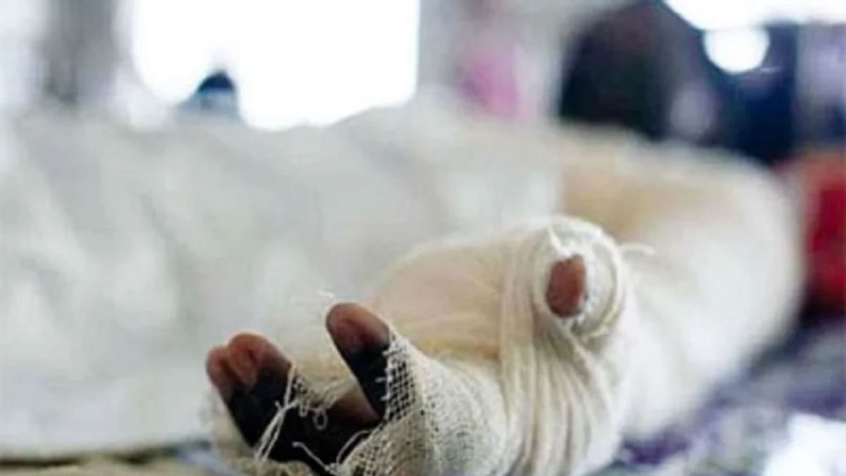 ট্রান্সফরমার বিস্ফোরণ: দগ্ধ হয়ে ছেলের মৃত্যু, বাবা-মা আশঙ্কাজনক